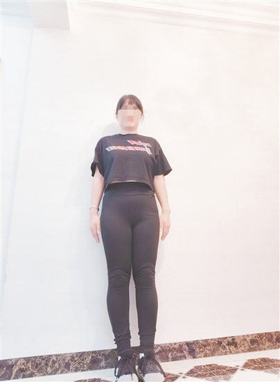 高女士減脂前后對(duì)比。